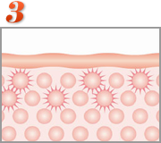 【3】振動させることによりマイクロバブルを発生させ弾けさせることで、脂肪細胞にダメージを与えます。